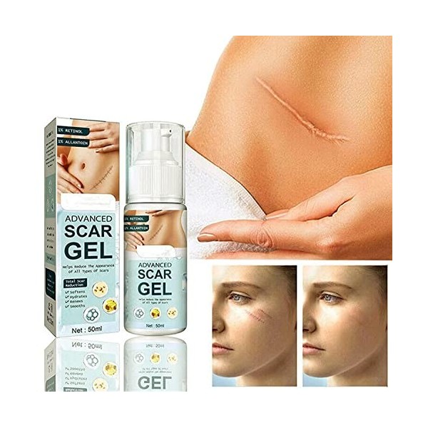 German Advanced Skin Renewal Gel, Silicone Skin Renewal Gel, Scar & Stretch Marks Remover Gel, for Injury,Old Scars and Burns...