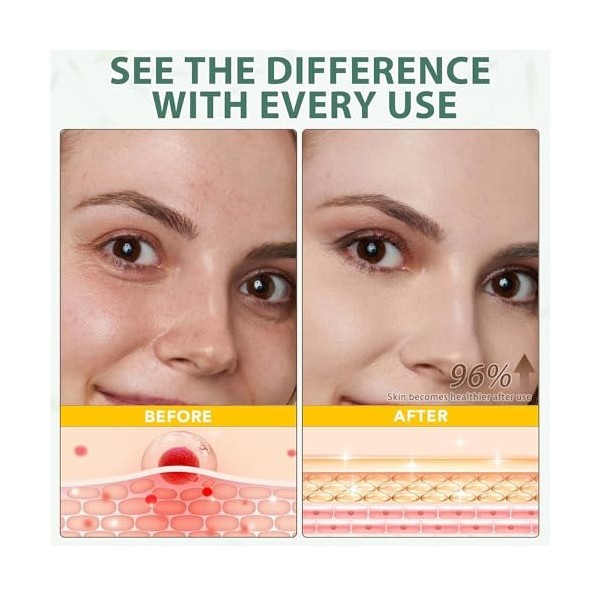 WYOSMALL Beef Tallow for Skin, Baume au Suif et au Miel Naturel et Biologique, Profonde Nourrissante, Suif de Bœuf pour les S