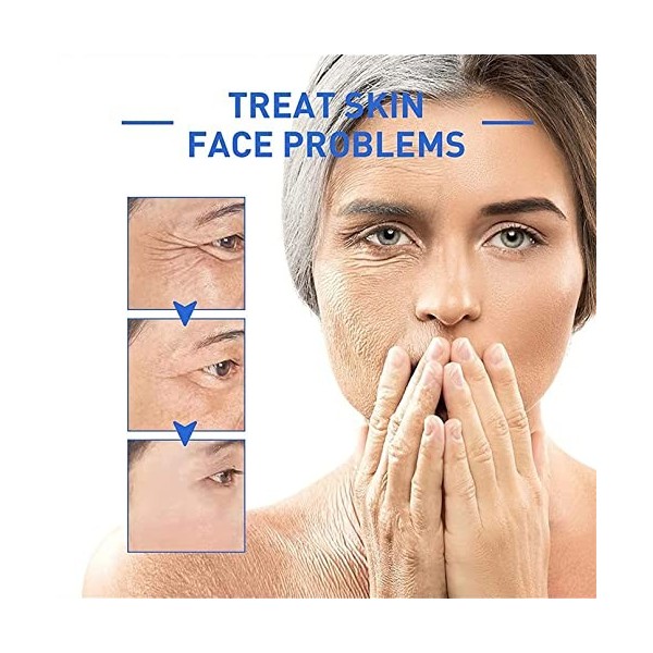 Botoxlux Anti Aging Serum,2PCS Flysmus Botoxlux Collagen Anti Aging Serum,Anti-wrinkle Serum,Collagen Boost Anti-aging Serum,