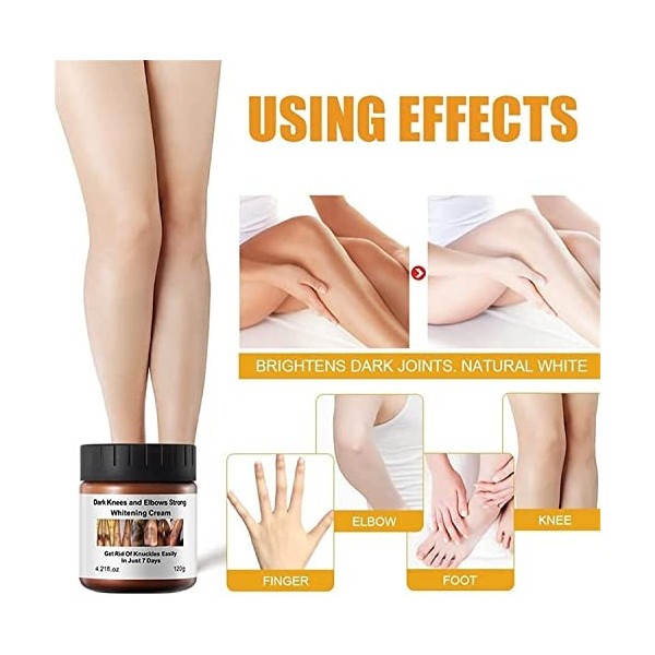 AcanthoGlow Lot de 2 crèmes thérapeutiques blanchissantes pour les phalanges, huile correctrice de taches sombres, crème blan