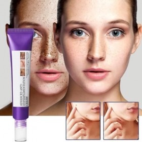 Crème pour le Visage Contre lHyperpigmentation | Hydratant Visage Portable 20g,Produit pour Éliminer les Imperfections Cutan