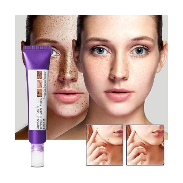 Crème pour le Visage Contre lHyperpigmentation | Hydratant Visage Portable 20g,Produit pour Éliminer les Imperfections Cutan