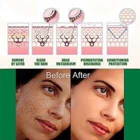 dijiusidy Femmes Visage Taches de rousseur sérum Anti-Imperfections Portable éclaircissant hydratant élimination des Taches N