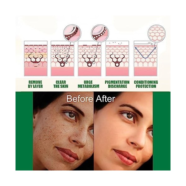 dijiusidy Femmes Visage Taches de rousseur sérum Anti-Imperfections Portable éclaircissant hydratant élimination des Taches N