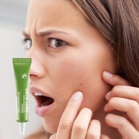 Crème anti-boutons - Crème anti-boutons apaisante et éclaircissante,Crème anti-cicatrices, crème éclaircissante pour la peau,