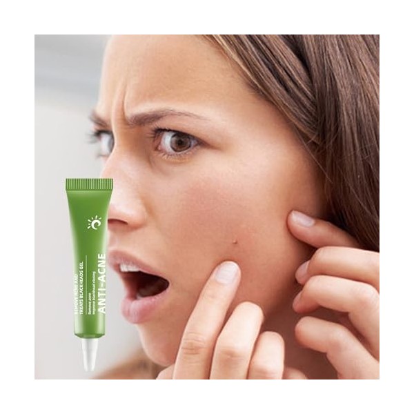 Crème anti-boutons - Crème anti-boutons apaisante et éclaircissante,Crème anti-cicatrices, crème éclaircissante pour la peau,