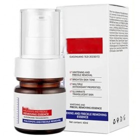 Aobenz Anti Spot Serum, Aobenz Whitening And Freckle Removing Essence,Vitamin C Blemish Serum For Face,Magic Whitening Spot C...