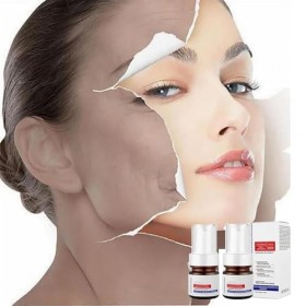 Aobenz Anti Spot Serum, Aobenz Whitening And Freckle Removing Essence,Vitamin C Blemish Serum For Face,Magic Whitening Spot C...