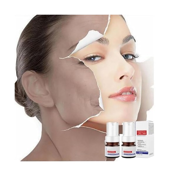 Aobenz Anti Spot Serum, Aobenz Whitening And Freckle Removing Essence,Vitamin C Blemish Serum For Face,Magic Whitening Spot C...