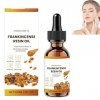 Huile pour le visage à la résine dencens,huile dencens pour la peau,sérum anti-âge naturel,hydratation plus profonde pour l