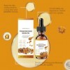 Huile pour le visage à la résine dencens,huile dencens pour la peau,sérum anti-âge naturel,hydratation plus profonde pour l