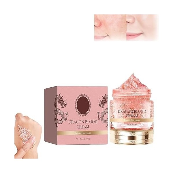 Dragon Blood Facial Cream, Retinol Placenta Dragon Blood Cream,Dragon Blood Anti Aging Face Cream, Face Skin Care Moisturizer...