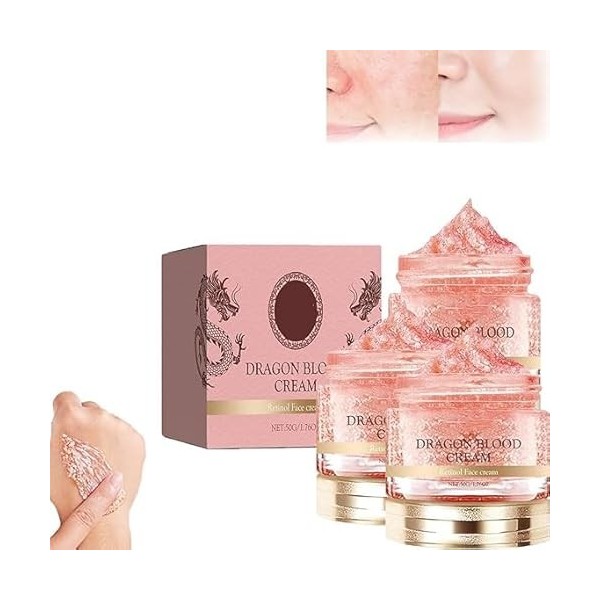 Dragon Blood Facial Cream, Retinol Placenta Dragon Blood Cream,Dragon Blood Anti Aging Face Cream, Face Skin Care Moisturizer...