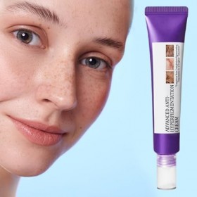 Crème Anti-Hyperpigmentation - Crème Faciale Naturelle 20g,Lotion Hydratante, Produit pour lAtténuation des Imperfections Cu