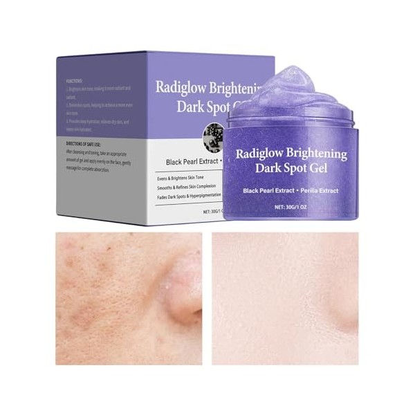 Gel Hydratant Visage,Gel de Soin Visage Doux 30 g - Crème Hydratante Éclaircissante et Nourrissante pour les Hommes et les Fe