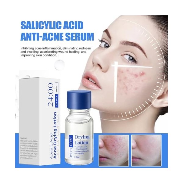 Lotion De Séchage À Bouton, Solution Zit À Action Rapide, Liquide Hydratant Pour Le Visage, 2,6x6,3 Cm, Séchage Rapide Et Lég