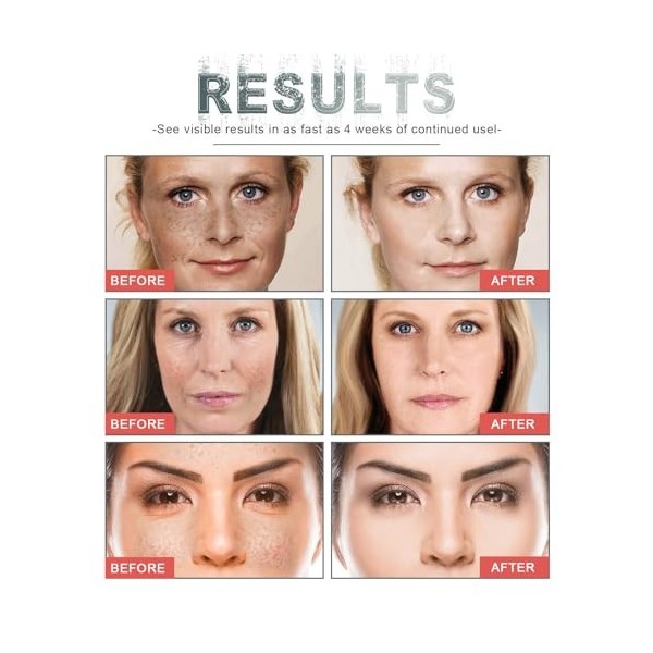 Lot de 2 sérums 30 Ml Sérum Anti-Rides & Anti-Âge, anti-rides au collagène pour le visage avec acide hyaluronique, Antirides 