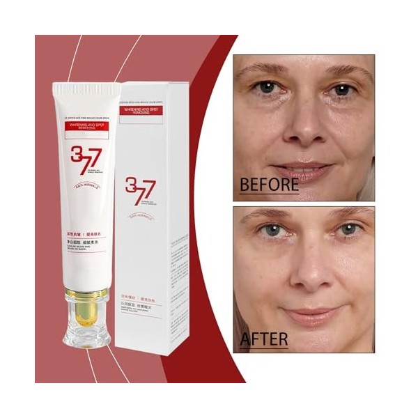 Crème anti-rides blanchissante 377, sérum anti-rides profondes, anti-taches brunes 377, soin hydratant pour la peau, crème vi...