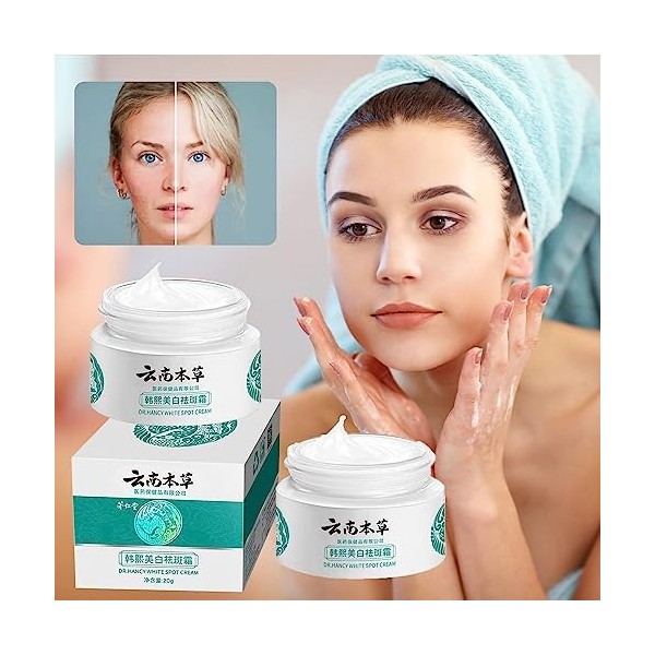 Lot de 2 crèmes japonaises Melasma - Crème démaquillante japonaise Herbal Freckle - Crème Hoshi Japon - Dr Hancy White Spot C...