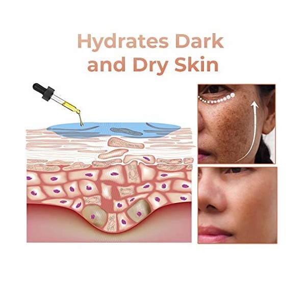 Melanin Correcting Facial Serum 30ml,2023 New Dark Spot Corrector Remover,Skin Care Moisturizing Repair Serum, Hyaluronic Aci...