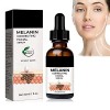 Melanin Correcting Facial Serum 30ml,2023 New Dark Spot Corrector Remover,Skin Care Moisturizing Repair Serum, Hyaluronic Aci...