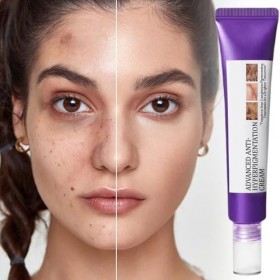 Crème Anti-Hyperpigmentation - Lait Nourrissant Visage 20 g,Lotion Hydratante, Produit pour lAtténuation des Imperfections C