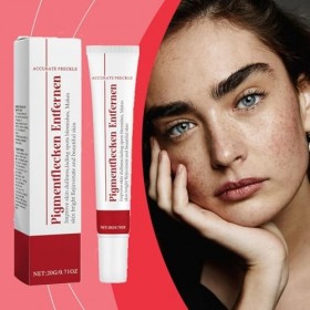 Crème éclaircissante pour éliminer les taches brunes du visage – Crème hydratante et éclaircissante, réduit les taches de rou...