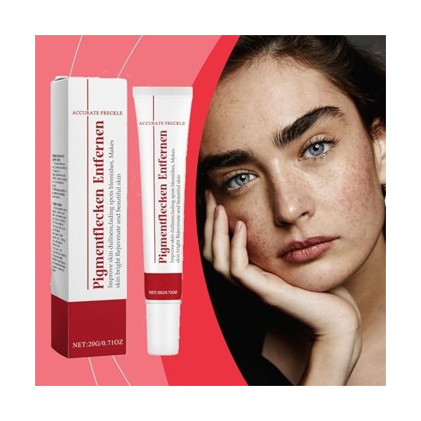Crème éclaircissante pour éliminer les taches brunes du visage – Crème hydratante et éclaircissante, réduit les taches de rou...