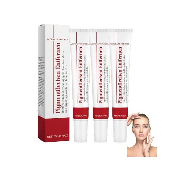 Crème éclaircissante pour éliminer les taches brunes du visage – Crème hydratante et éclaircissante, réduit les taches de rou...