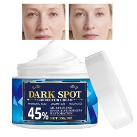 Tyinerc Crème unifiante teint - Boost déclat corps | Crème réparatrice pour teint irrégulier,pour coudes genoux mains bras j