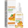 Turmeric Skincare Set, Turmeric Anti Oxidation Face Serum,Turmeric Dark Spot Corrector Serum for Reduces Fine Lines and Dark ...