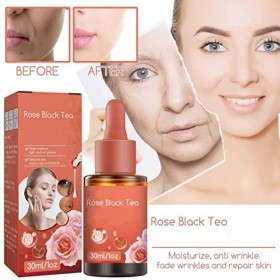 Rose Black Tea Squalane Essential Oil,Anti-aging Anti-wrinkle Serum Moisturising Serum,Organic Rose Phyto Facial Oil,Pore Shr...