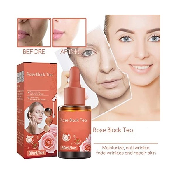 Rose Black Tea Squalane Essential Oil,Anti-aging Anti-wrinkle Serum Moisturising Serum,Organic Rose Phyto Facial Oil,Pore Shr...