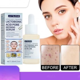 Jeune acide lactobionique - Huile dacide lactobionique douce pour le visage,30ml Face Intensive Hydrate & Adoucit la peau Po