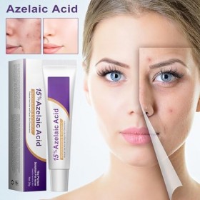 Crème Hydratante - Baume Visage 20g,Lotion Hydratante Visage Apaisante Hommes Femmes Hydratation Éclat