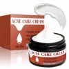 Crème Anti-Acné 35 g, Traitement Localisé Pour le Visage, Crème Hydratante Pour le Visage Adaptée à Tous les Types de Peau, P