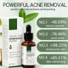 30ml Sérum Anti-Acné,Essence Soin Visage pour une peau nette,Réduit efficacement pour Atténuer Boutons,Points Noirs et Marque
