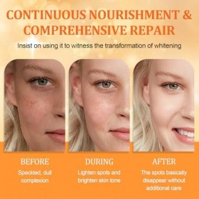 Serum Vitamine C,Serum Visage,Con Vitamine C Et Niacinamide,Anti-Rides, Anti-Taches Et Hydratant,Uniformise Le Teint And Illu