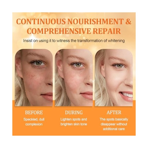 Serum Vitamine C,Serum Visage,Con Vitamine C Et Niacinamide,Anti-Rides, Anti-Taches Et Hydratant,Uniformise Le Teint And Illu