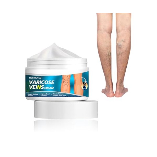 Varices Jambes Crème Soin des Jambes pour Varice,Cream Anti Varices Crème pour Varice,30g