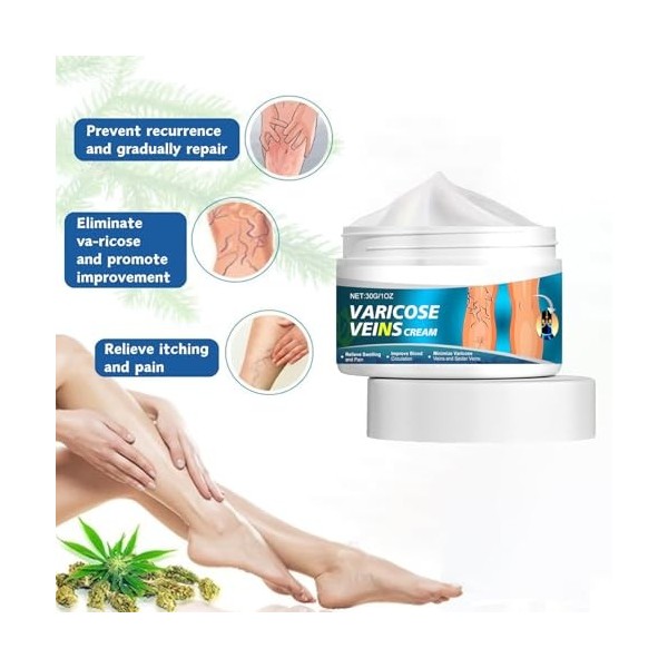 Varices Jambes Crème Soin des Jambes pour Varice,Cream Anti Varices Crème pour Varice,30g