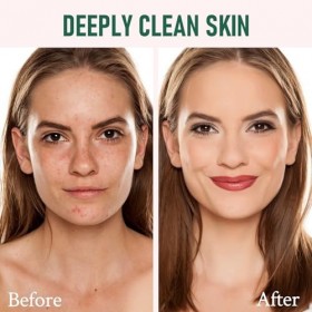 Crème anti-rides venin dabeille,Recovery pour tous types de peau Crème Jour et Nuit