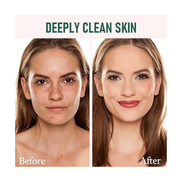 Crème anti-rides venin dabeille,Recovery pour tous types de peau Crème Jour et Nuit