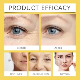 Huile dencens pour la peau, sérum visage anti-rides et anti-âge, sérum pour le visage pour tous les types de peau, lisse les ...