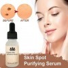 Skin Corrector Clarifying Serum,Organic Skin Spot Solutions Sérum,Sérum Purifiant Anti-taches De Peau Bio, Sérum De Solutions