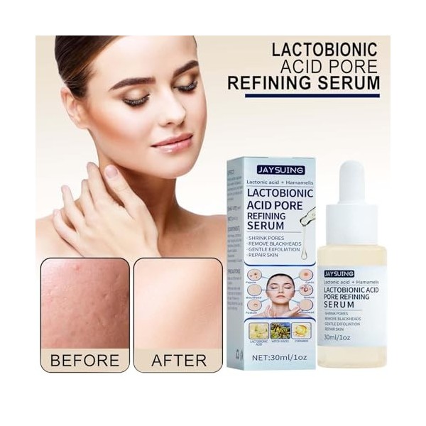 lyanny Acide lactobionique jeune | Acide lactobionique doux hydratant | 30 ml Instant Lactobionic Acid Face Oil Pore Instant 