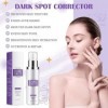 Dark Spot Correcting Glow Serum,Whitening and Freckle Removing Essence,Anti Spot Serum,Wrinkle Power,Dark Spots R𝐞mover for F...