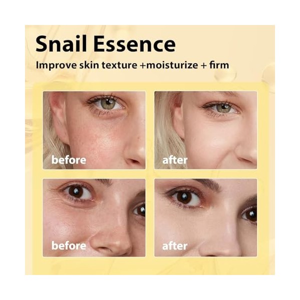 100ml Sérum Hydratant, Soin Visage de Haute Qualité, Sérum dHydratation