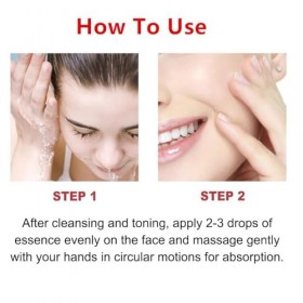 Dark Spot Correcting Sérum, Sérum à la Niacinamide, Sérum Correcteur de Taches Brunes, Sérum Correcteur de Points Sombres, Hy