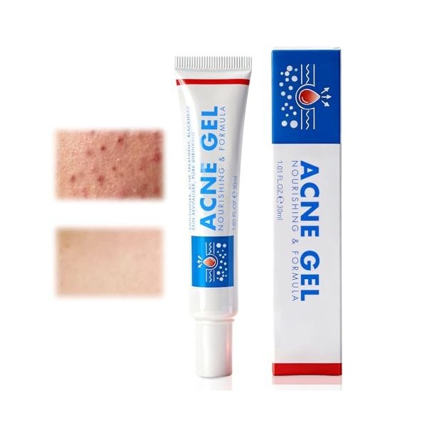 30g Peaux purifiant Crème Visage,Crème Apaisante,Formule Soin gel,Affine le grain de Peau,Pour une peau plus nette et équilib